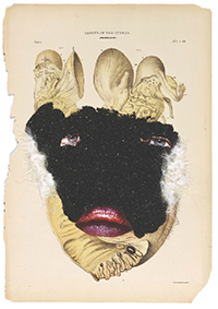 Wangechi Mutu - Histology of the Different Classes of Uterine Tummors (2004)