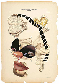 Wangechi Mutu - Histology of the Different Classes of Uterine Tummors (2004)